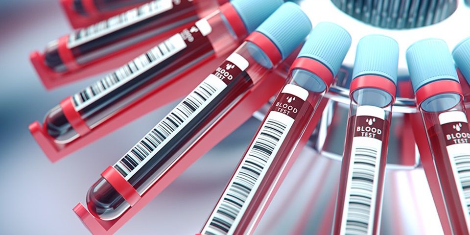 Close up image of blood vials for testing Close up image of blood vials for testing